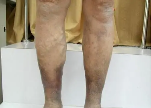 QQ截图20220306153315.png