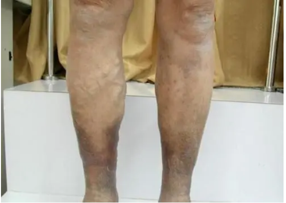 QQ截图20220308102201.png