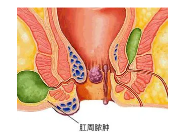 QQ截图20220507172924.png
