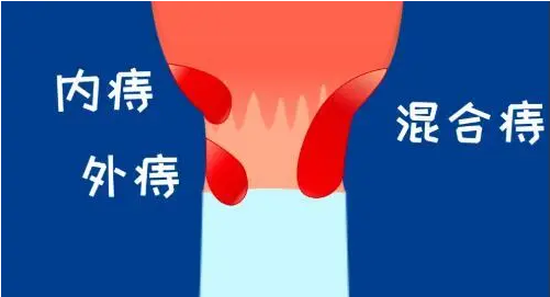 QQ截图20220508151158.png