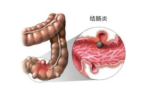 QQ截图20220509163644.png
