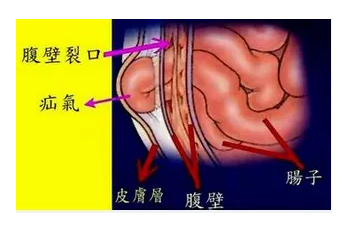 QQ截图20220516152522.png