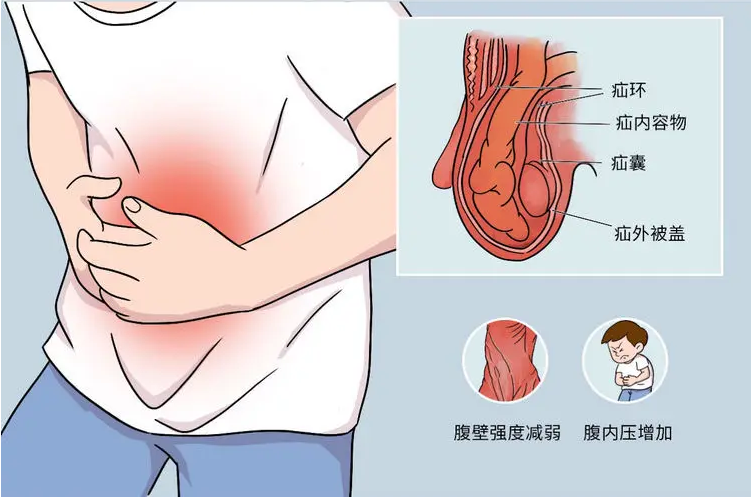 QQ截图20220518104020.png