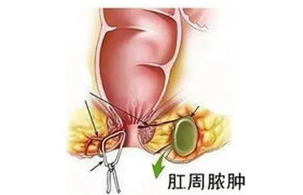 QQ截图20220603102911.png