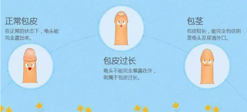 QQ截图20220614150044.png